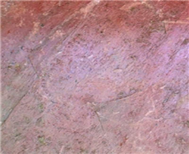 Multi Pink